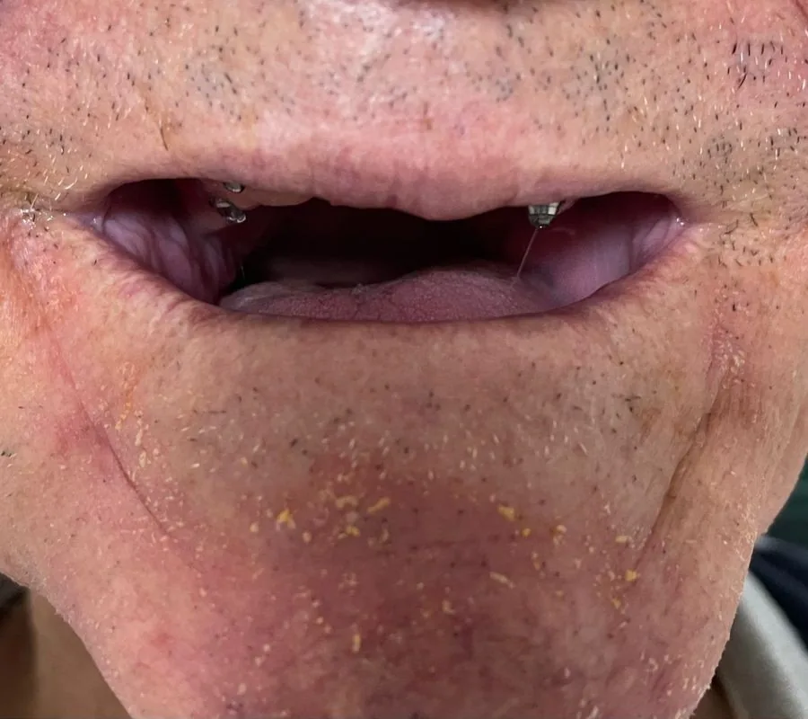 Mesmo paciente após reabilitação dental completa