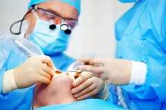 Cirurgia Oral em Hortolândia — Extração de Siso