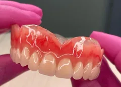 Prótese Dentária em Hortolândia